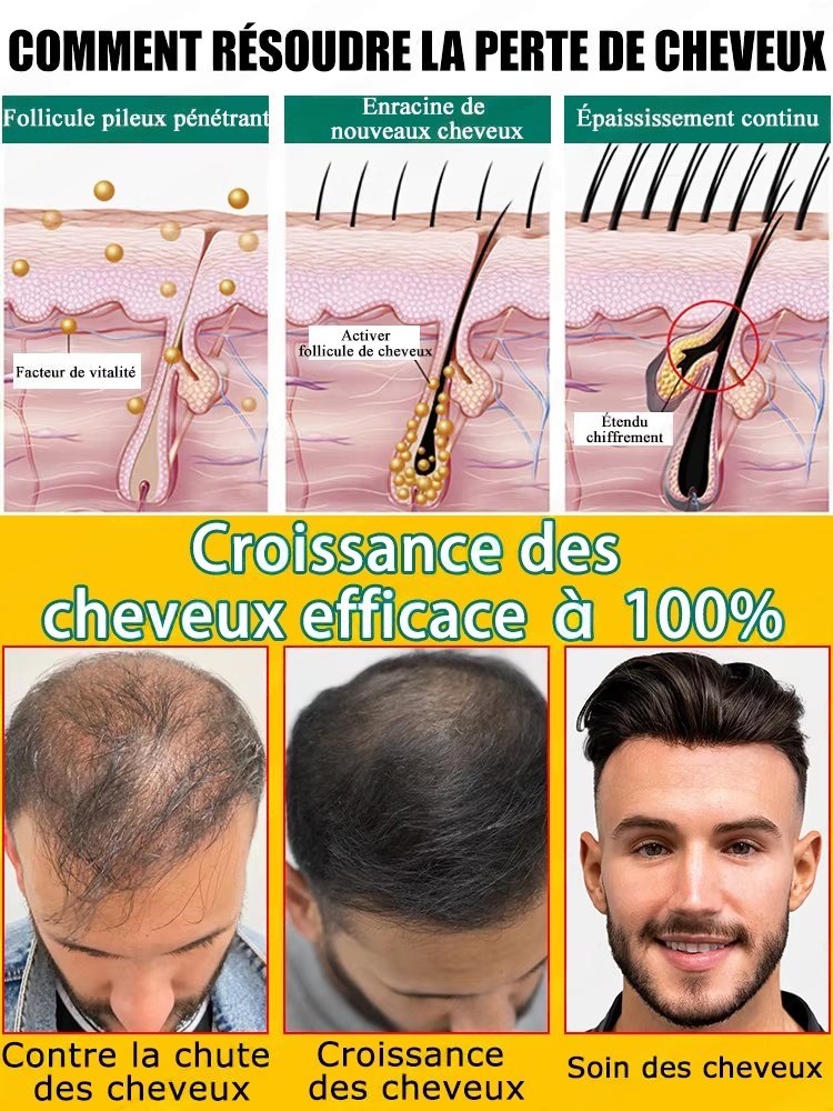 Daily Ginger Scalp Nourish Liq - Hair Care For Hair Fall recension och pris