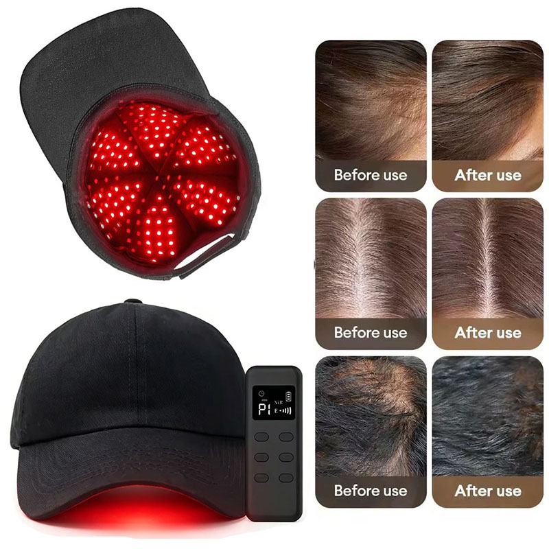 660nm 940nm Light 142 Groups / - Hair Care Wella recension och pris